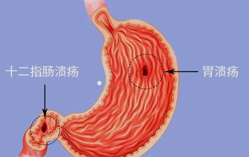 长期便秘对身体的危害是什么