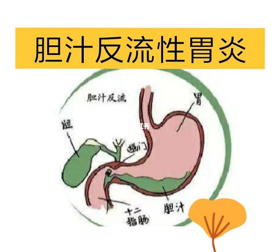 急性胃炎怎么养护