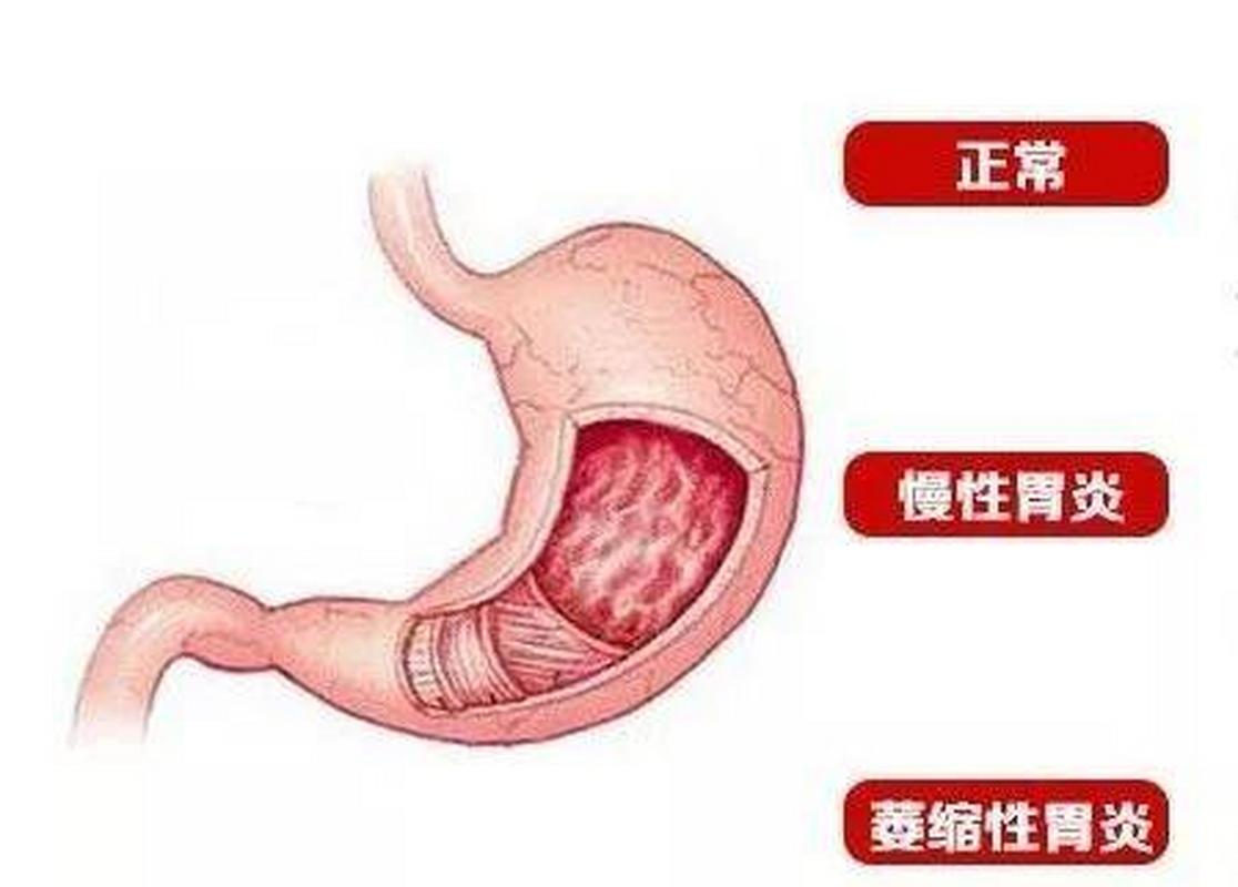 腹泻会给患者造成什么危害