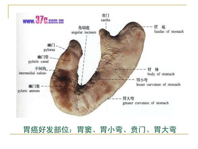 胃酸过多应该吃什么比较好