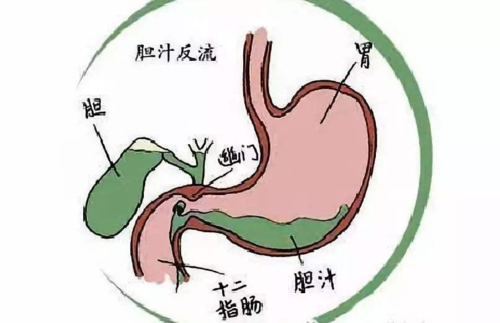 避免浅表性胃炎传染的方法_2